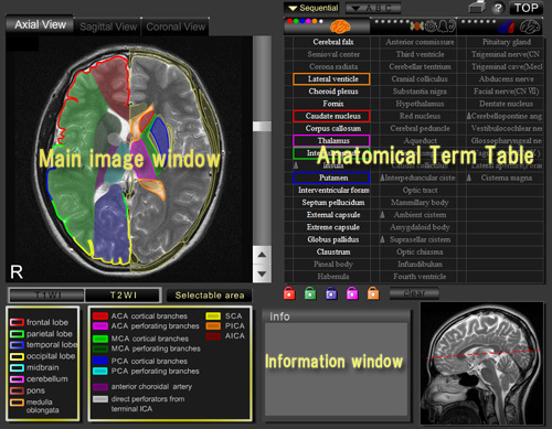 CT and MRI Interactive Atlas of Cross-Sectional Anatomy