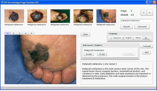 YSP Dermatology Image Database AIR