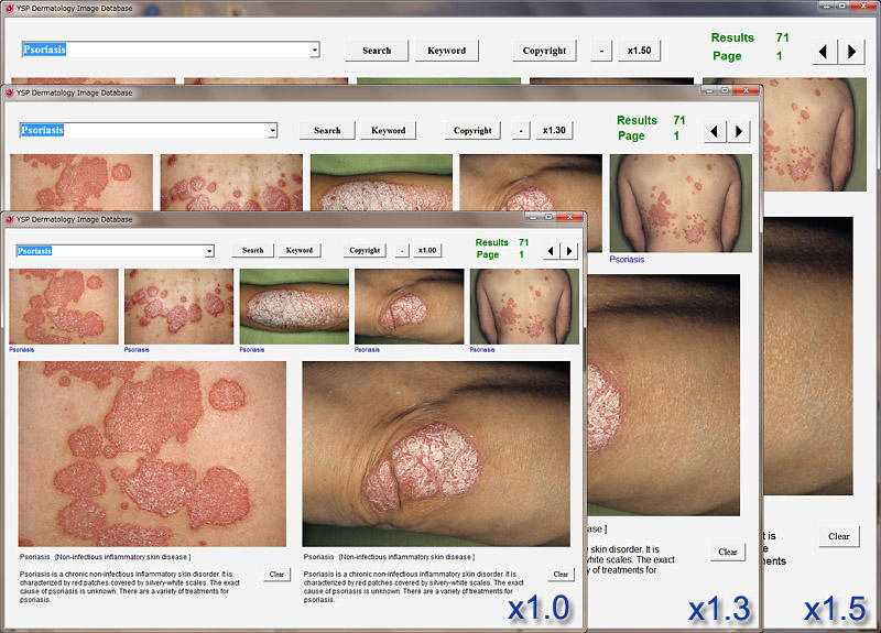 YSP Dermatology Image Database